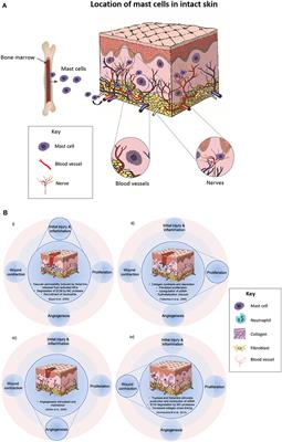 Mast Cells in Skin Scarring: A Review of Animal and Human Research